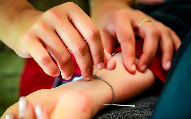 Professionelles Akupunktur-Wellness-Erlebnis