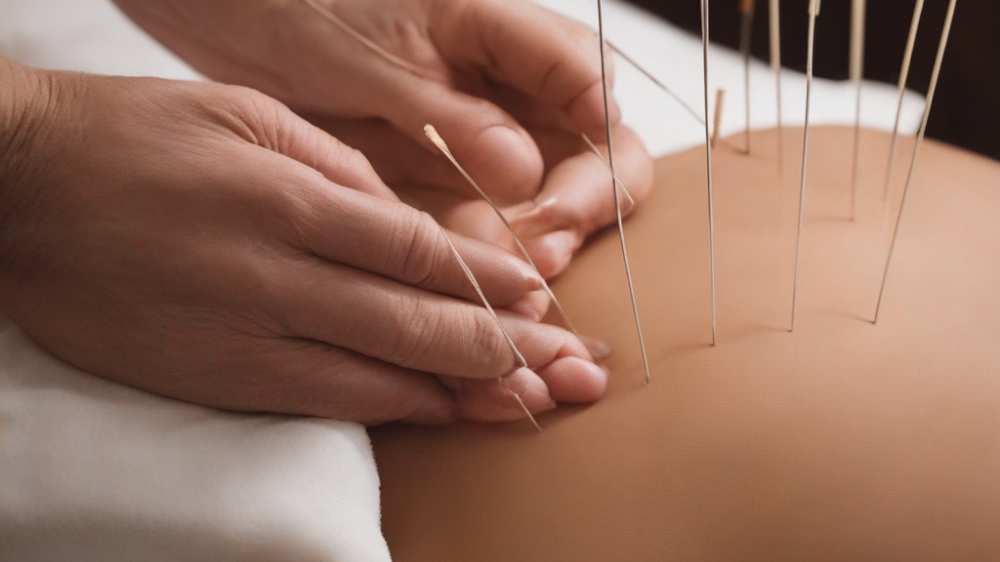 Akupunktur-Behandlungssituation